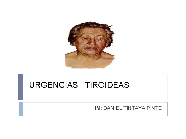  URGENCIAS TIROIDEAS IM: DANIEL TINTAYA PINTO 