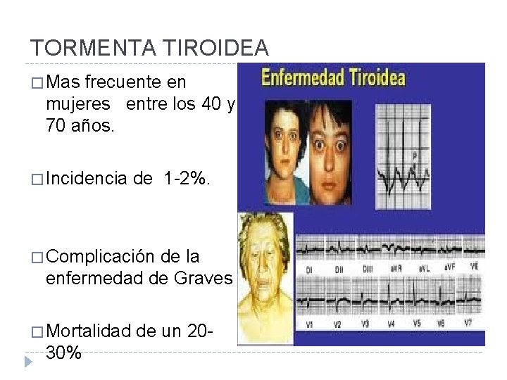TORMENTA TIROIDEA � Mas frecuente en mujeres entre los 40 y 70 años. �