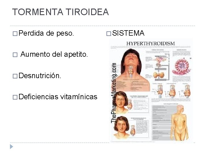 TORMENTA TIROIDEA � Perdida de peso. � SISTEMA METABOLICO � Aumento del apetito. �