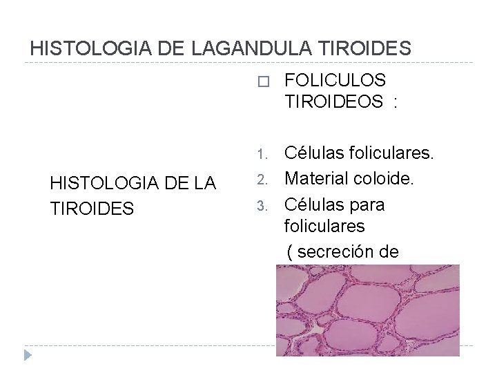 HISTOLOGIA DE LAGANDULA TIROIDES � FOLICULOS TIROIDEOS : Células foliculares. 2. Material coloide. 3.