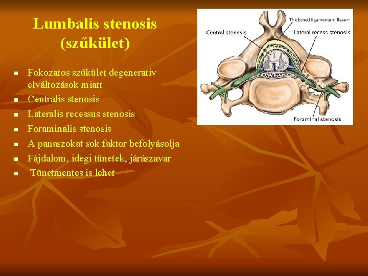 Lumbalis stenosis (szűkület) n n n n Fokozatos szűkület degenerativ elváltozások miatt Centralis stenosis