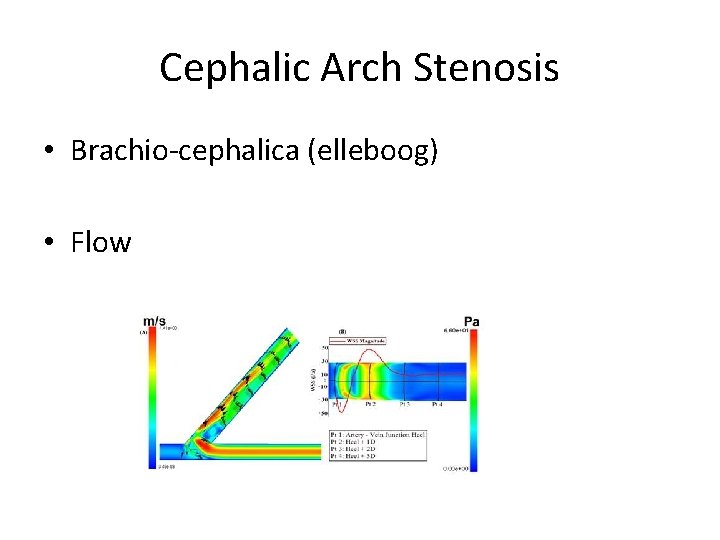 Cephalic Arch Stenosis • Brachio-cephalica (elleboog) • Flow 