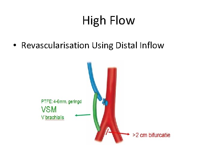 High Flow • Revascularisation Using Distal Inflow 