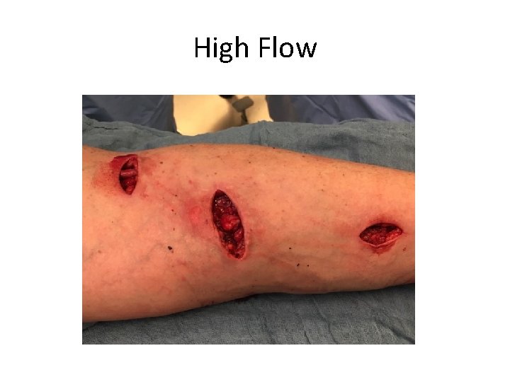 High Flow 