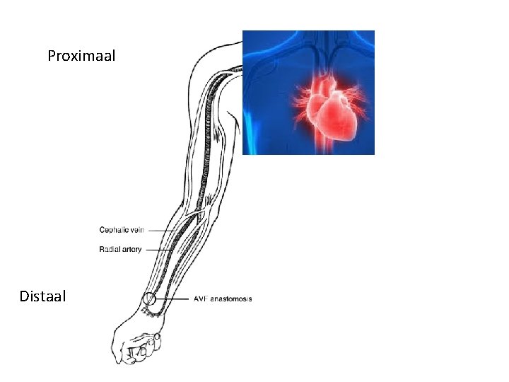 Proximaal Distaal 