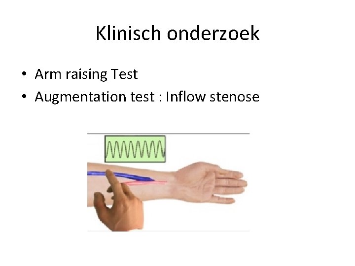 Klinisch onderzoek • Arm raising Test • Augmentation test : Inflow stenose 
