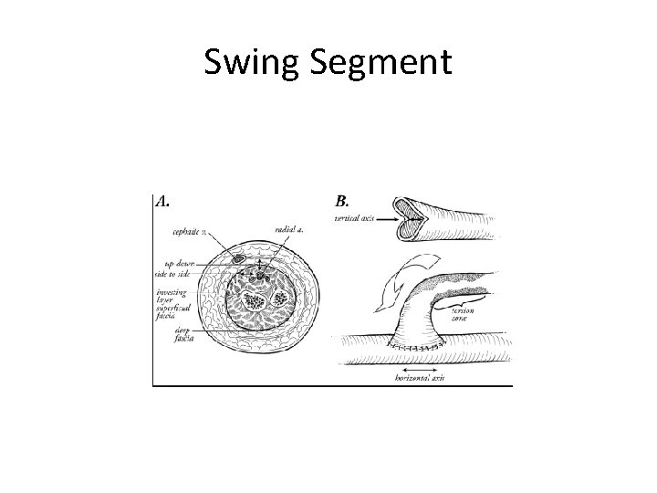Swing Segment 