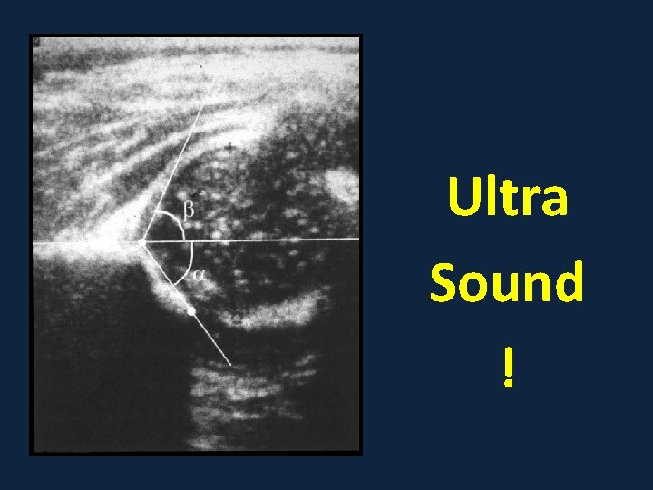 Ultra Sound ! 