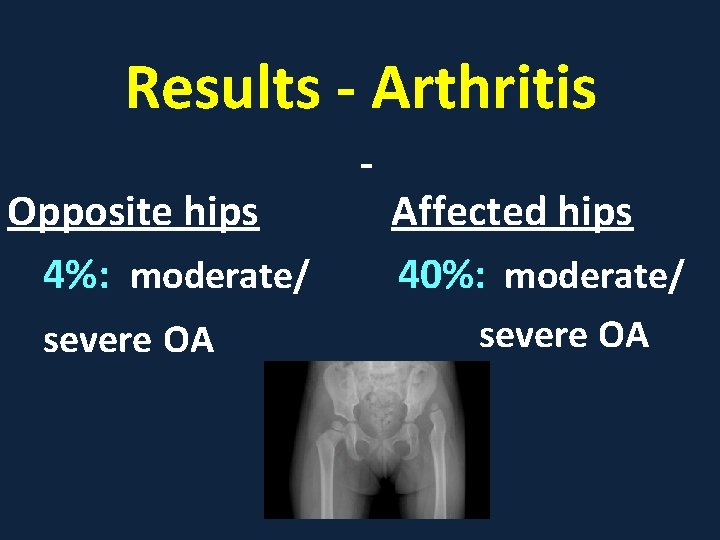 Results - Arthritis Opposite hips 4%: moderate/ severe OA Affected hips 40%: moderate/ severe