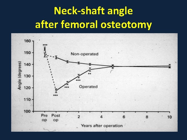 Neck-shaft angle after femoral osteotomy 