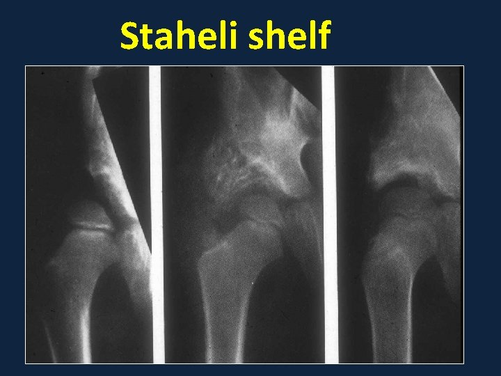 Staheli shelf 