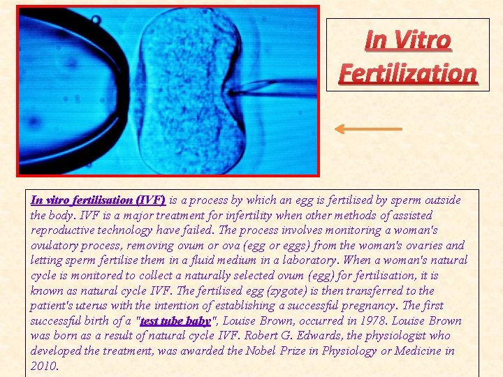 In Vitro Fertilization In vitro fertilisation (IVF) is a process by which an egg