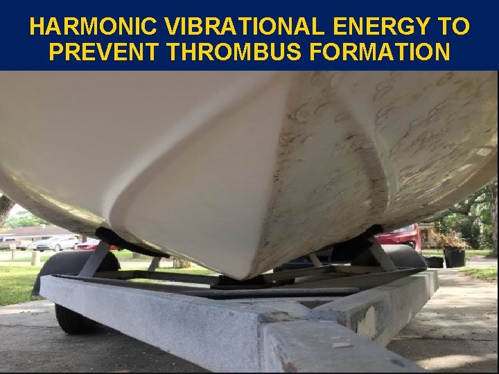 HARMONIC VIBRATIONAL ENERGY TO PREVENT THROMBUS FORMATION HARMONIC VIBRATIONAL ENERGY TO PREVENT THROMBUS FORMATION