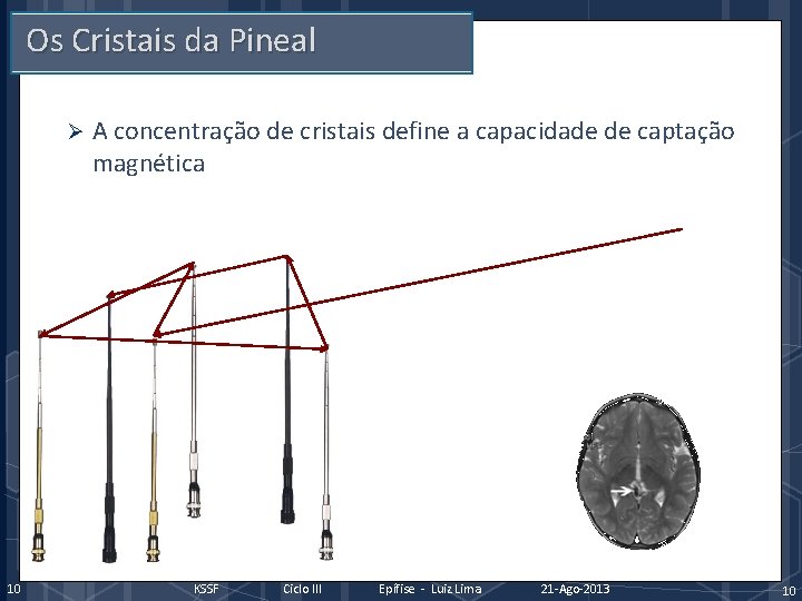 Os Cristais da Pineal Ø 10 A concentração de cristais define a capacidade de