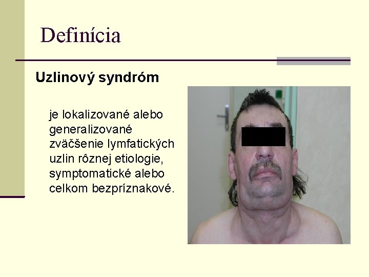 Definícia Uzlinový syndróm je lokalizované alebo generalizované zväčšenie lymfatických uzlin rôznej etiologie, symptomatické alebo