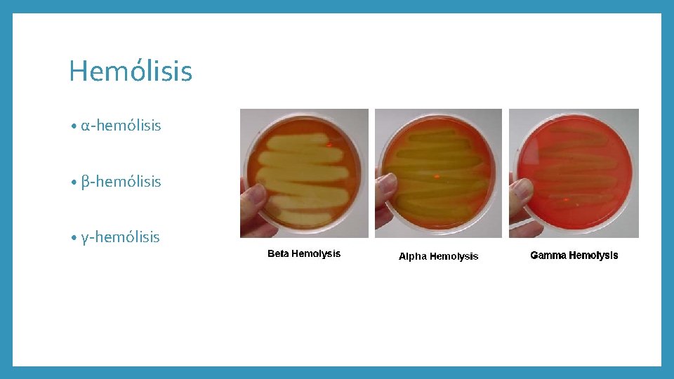 Hemólisis • α-hemólisis • β-hemólisis • γ-hemólisis 