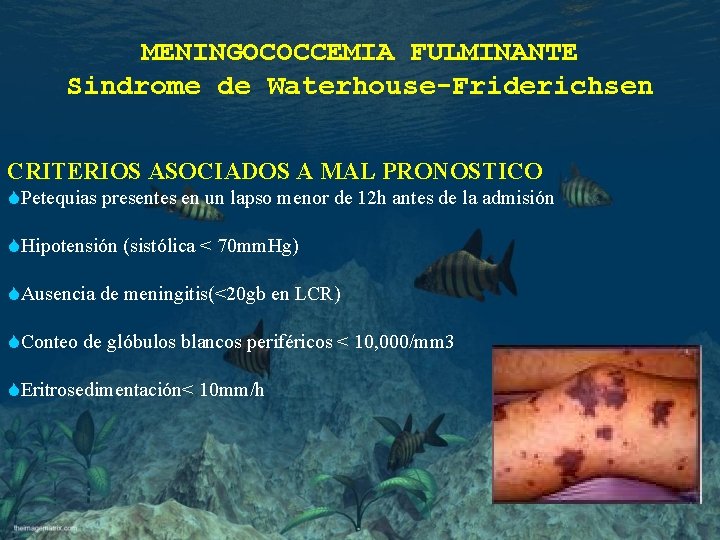 MENINGOCOCCEMIA FULMINANTE Sindrome de Waterhouse-Friderichsen CRITERIOS ASOCIADOS A MAL PRONOSTICO SPetequias presentes en un