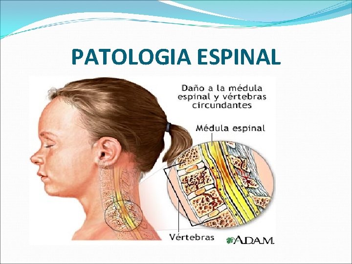 PATOLOGIA ESPINAL 