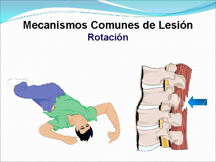 Mecanismos Comunes de Lesión Rotación 