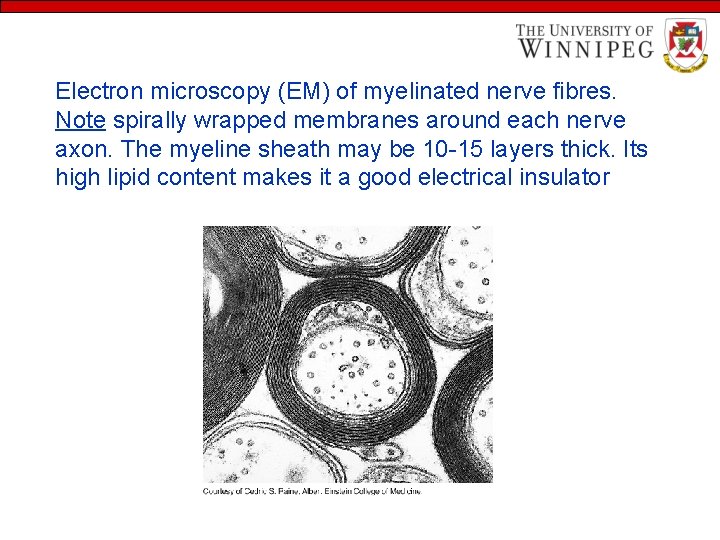 Electron microscopy (EM) of myelinated nerve fibres. Note spirally wrapped membranes around each nerve