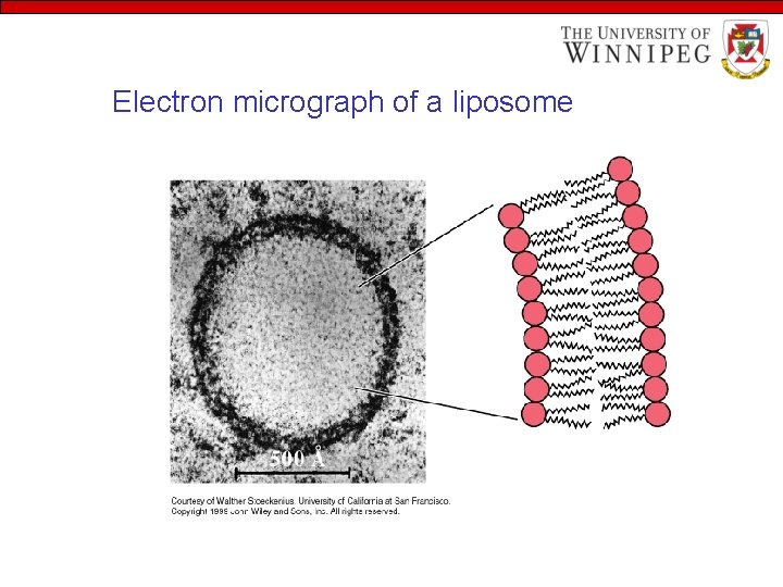 Electron micrograph of a liposome 