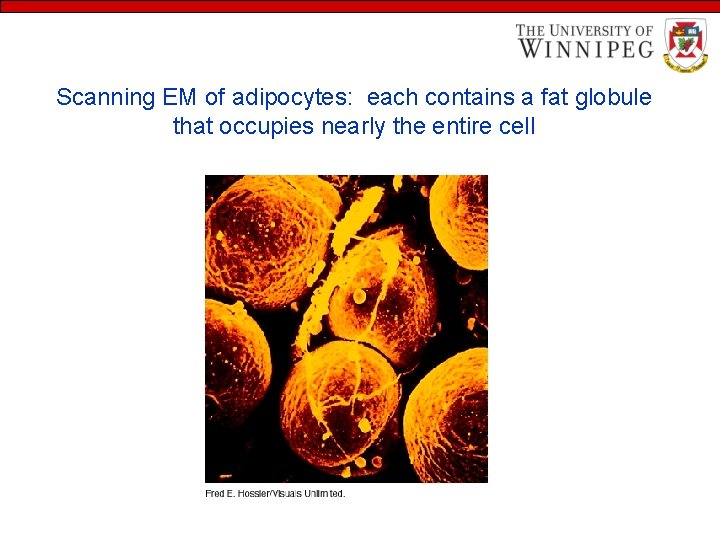 Scanning EM of adipocytes: each contains a fat globule that occupies nearly the entire