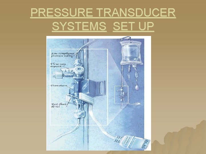 PRESSURE TRANSDUCER SYSTEMS SET UP PRESSURE TRANSDUCER SYSTEMS SET UP