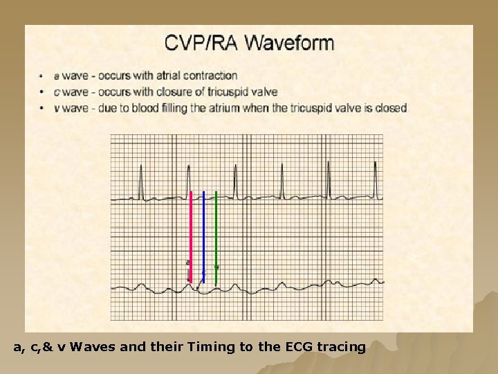 a, c, & v Waves and their Timing to the ECG tracing a, c, & v Waves and their Timing to the ECG tracing