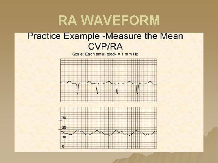 RA WAVEFORM RA WAVEFORM