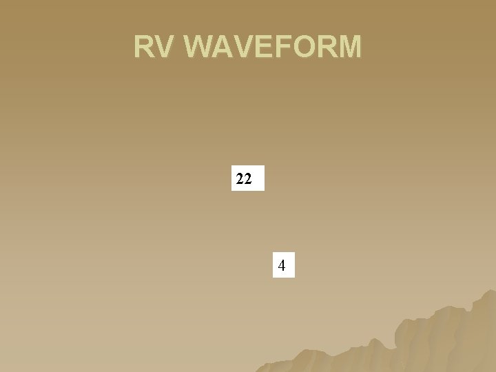 RV WAVEFORM 22 4 RV WAVEFORM 22 4