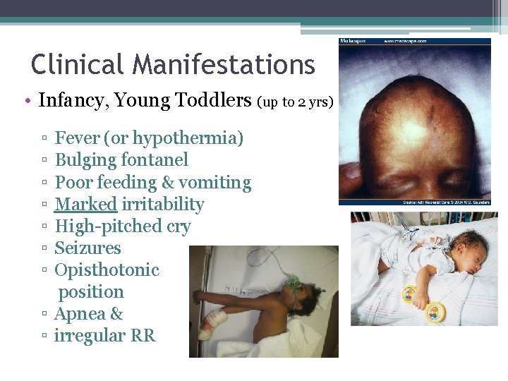 Clinical Manifestations • Infancy, Young Toddlers (up to 2 yrs) ▫ ▫ ▫ ▫ Clinical Manifestations • Infancy, Young Toddlers (up to 2 yrs) ▫ ▫ ▫ ▫