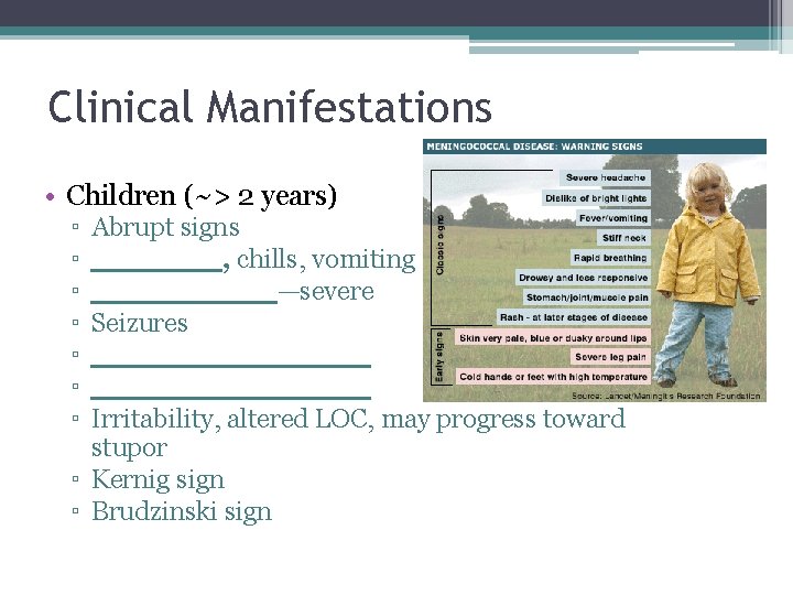 Clinical Manifestations • Children (~> 2 years) ▫ ▫ ▫ ▫ Abrupt signs _______, Clinical Manifestations • Children (~> 2 years) ▫ ▫ ▫ ▫ Abrupt signs _______,