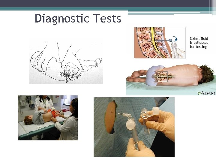 Diagnostic Tests Diagnostic Tests