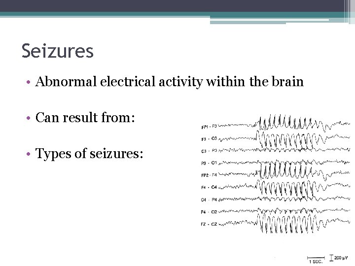 Seizures • Abnormal electrical activity within the brain • Can result from: • Types Seizures • Abnormal electrical activity within the brain • Can result from: • Types