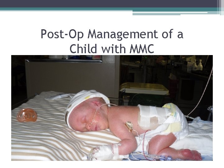 Post-Op Management of a Child with MMC Post-Op Management of a Child with MMC