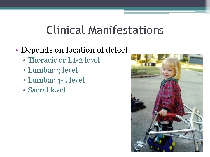 Clinical Manifestations • Depends on location of defect: ▫ ▫ Thoracic or L 1 Clinical Manifestations • Depends on location of defect: ▫ ▫ Thoracic or L 1