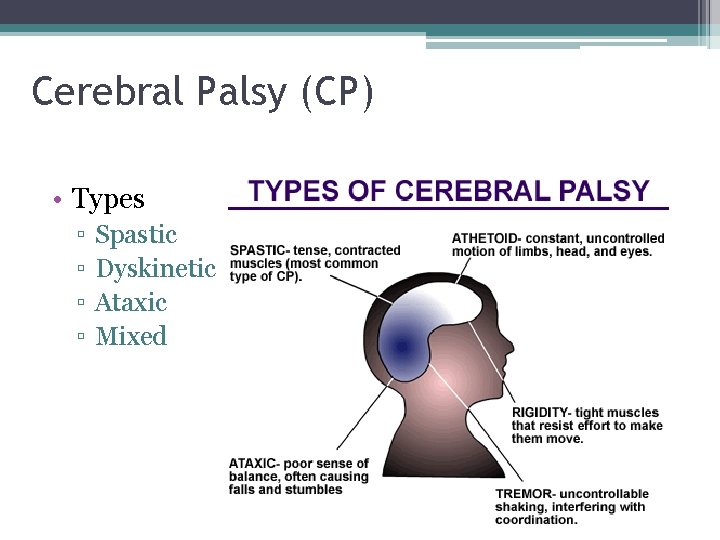 Cerebral Palsy (CP) • Types ▫ ▫ Spastic Dyskinetic Ataxic Mixed Cerebral Palsy (CP) • Types ▫ ▫ Spastic Dyskinetic Ataxic Mixed
