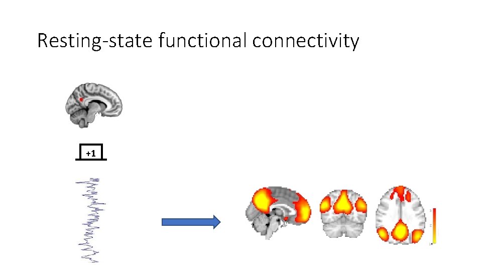 Resting-state functional connectivity +1 