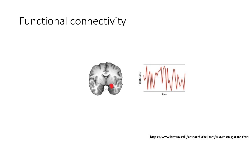Functional connectivity https: //www. brown. edu/research/facilities/mri/resting-state-fmri 