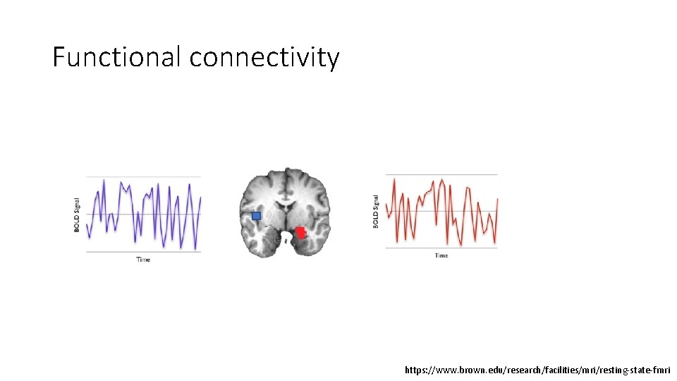 Functional connectivity https: //www. brown. edu/research/facilities/mri/resting-state-fmri 