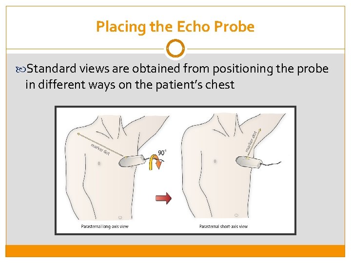 Placing the Echo Probe Standard views are obtained from positioning the probe in different
