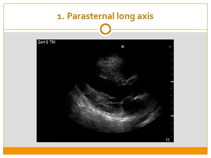 1. Parasternal long axis 