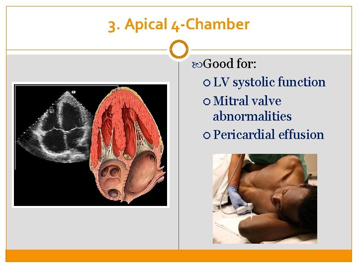 3. Apical 4 -Chamber Good for: LV systolic function Mitral valve abnormalities Pericardial effusion