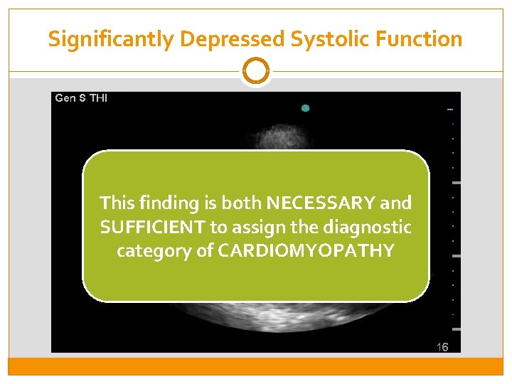 Significantly Depressed Systolic Function This finding is both NECESSARY and SUFFICIENT to assign the