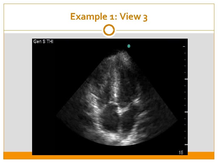 Example 1: View 3 