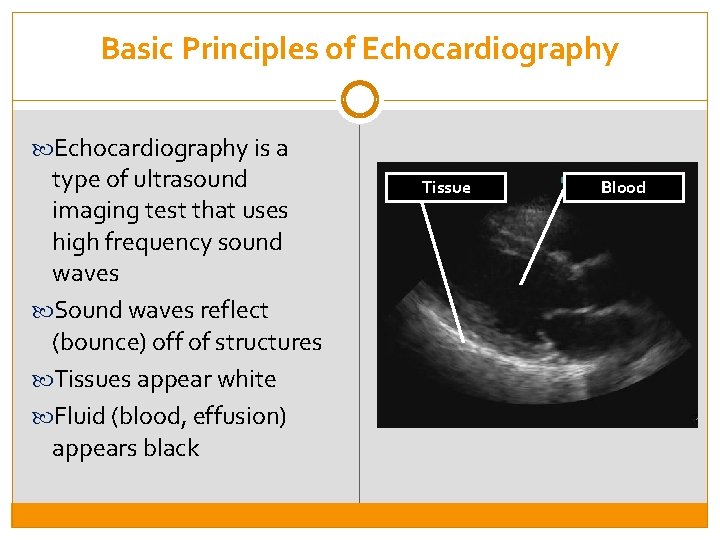 Basic Principles of Echocardiography is a type of ultrasound imaging test that uses high
