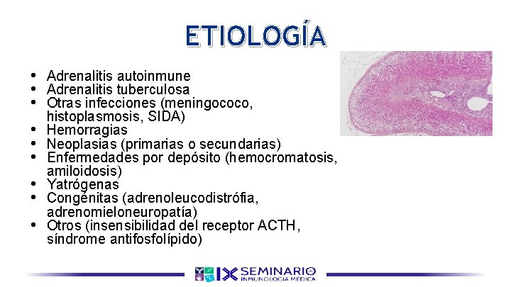 ETIOLOGÍA • Adrenalitis autoinmune • Adrenalitis tuberculosa • Otras infecciones (meningococo, • • •