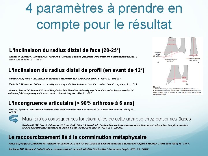4 paramètres à prendre en compte pour le résultat L’inclinaison du radius distal de