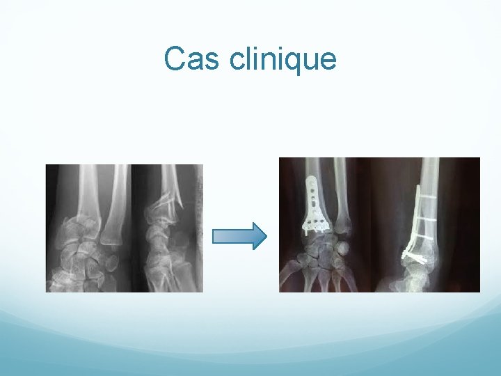 Cas clinique 