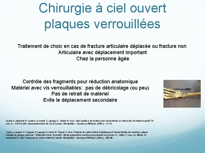 Chirurgie à ciel ouvert plaques verrouillées Traitement de choix en cas de fracture articulaire